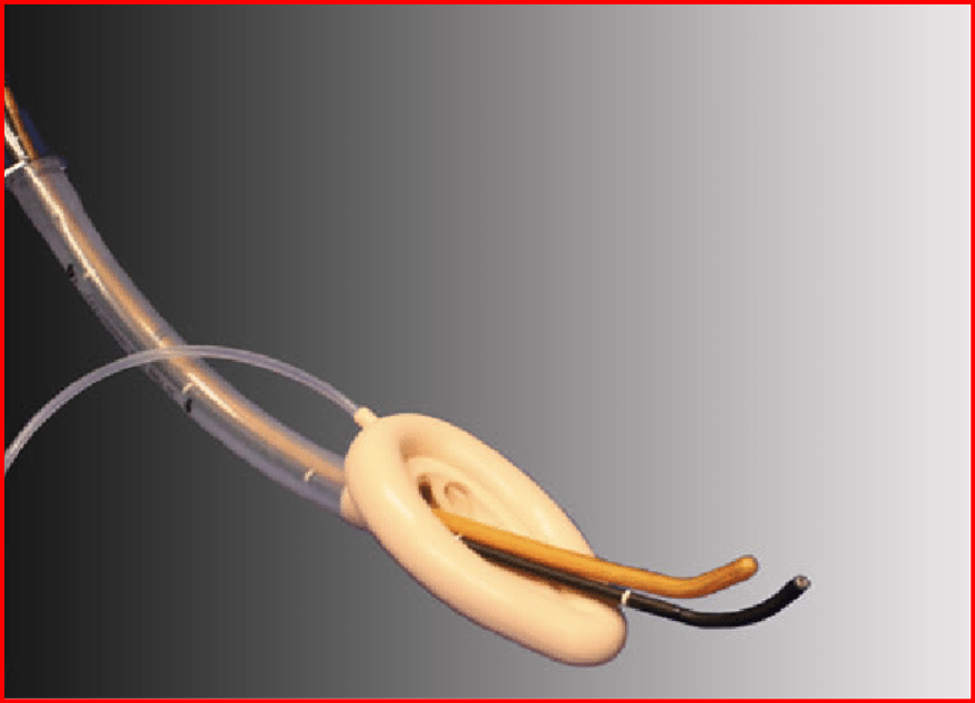 Bronchoscope,Tube,Guide