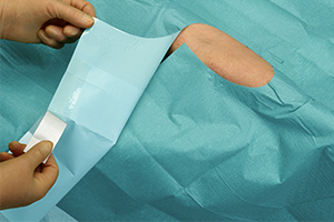 Aperture,Drape,Adhesive